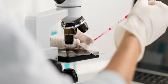 Mão com luvas posiciona uma amostra de sangue na lâmina de um microscópio no laboratório
